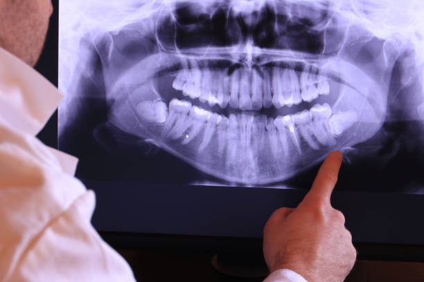 Best Cosmetic Emergency Dentistry in Wood River, IL