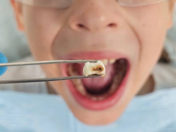 Best Same-Day Emergency Dental Services in Wood River, IL