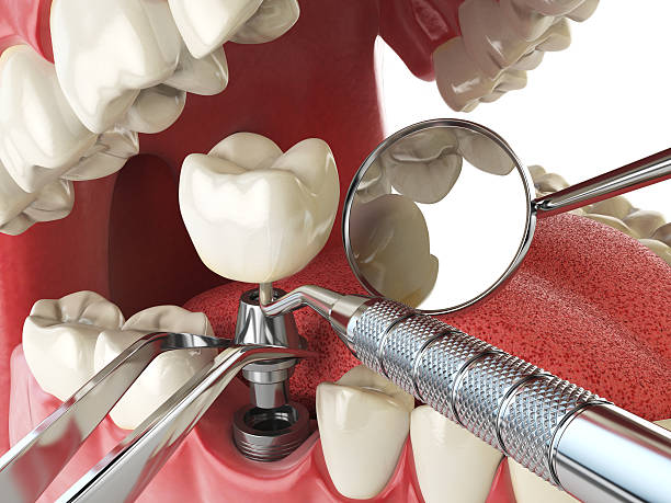 Best Weekend Emergency Dentist in Wood River, IL