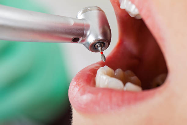 Best Same-Day Emergency Dental Services in Wood River, IL
